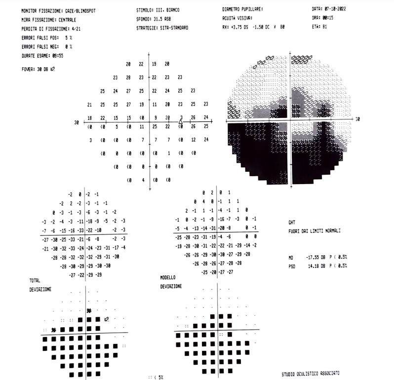 GLAUCOMA AD ANGOLO APERTO: LA DIAGNOSTICA